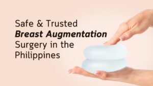 Read more about the article Safe & Trusted Breast Augmentation Surgery in the Philippines – Manny & Pie Calayan Clinic